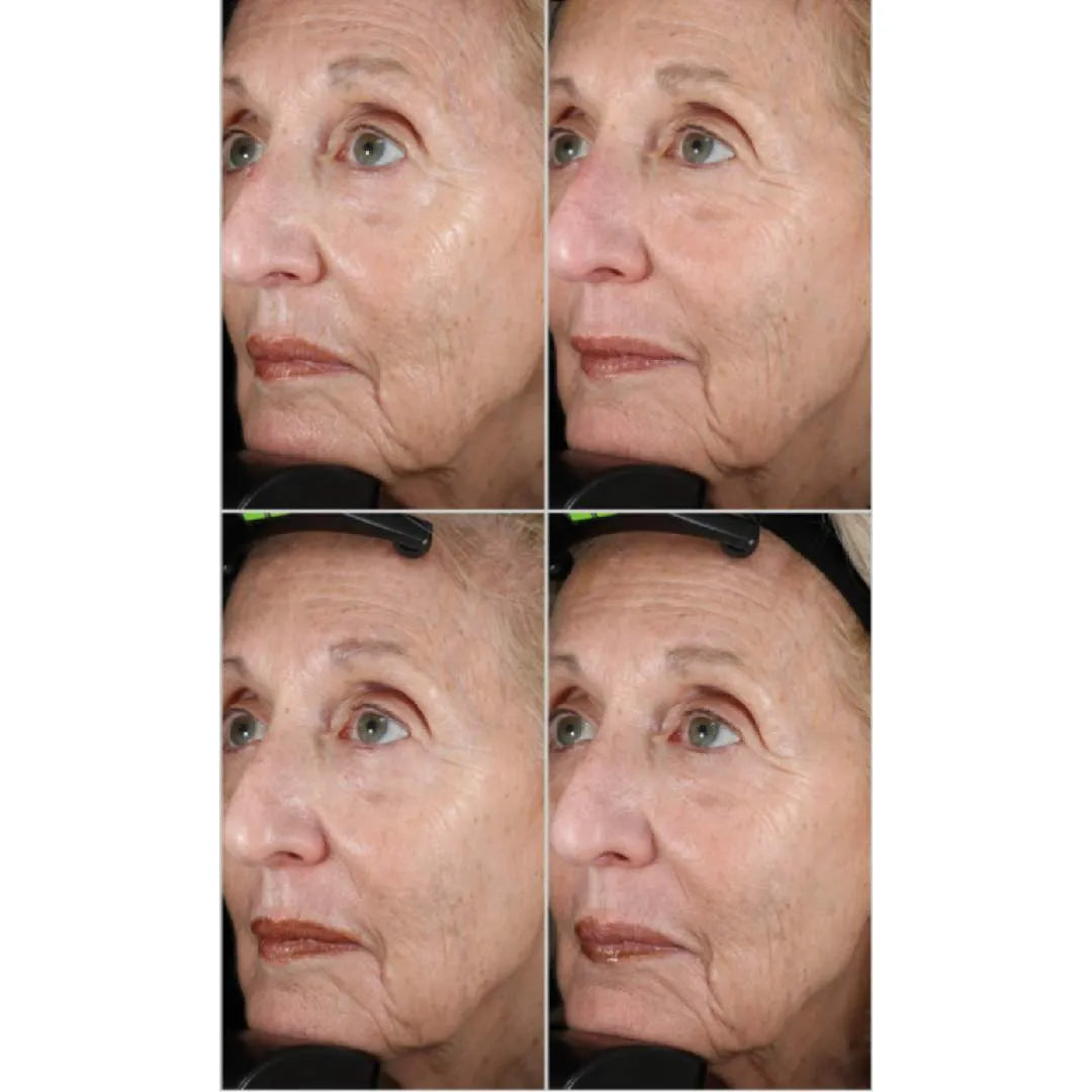 Four close-up side views of an older woman's face showing skin texture and wrinkles under different lighting conditions