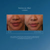Side-by-side close-up of lower face before and after two weeks using Daily Dynamic Hydrator