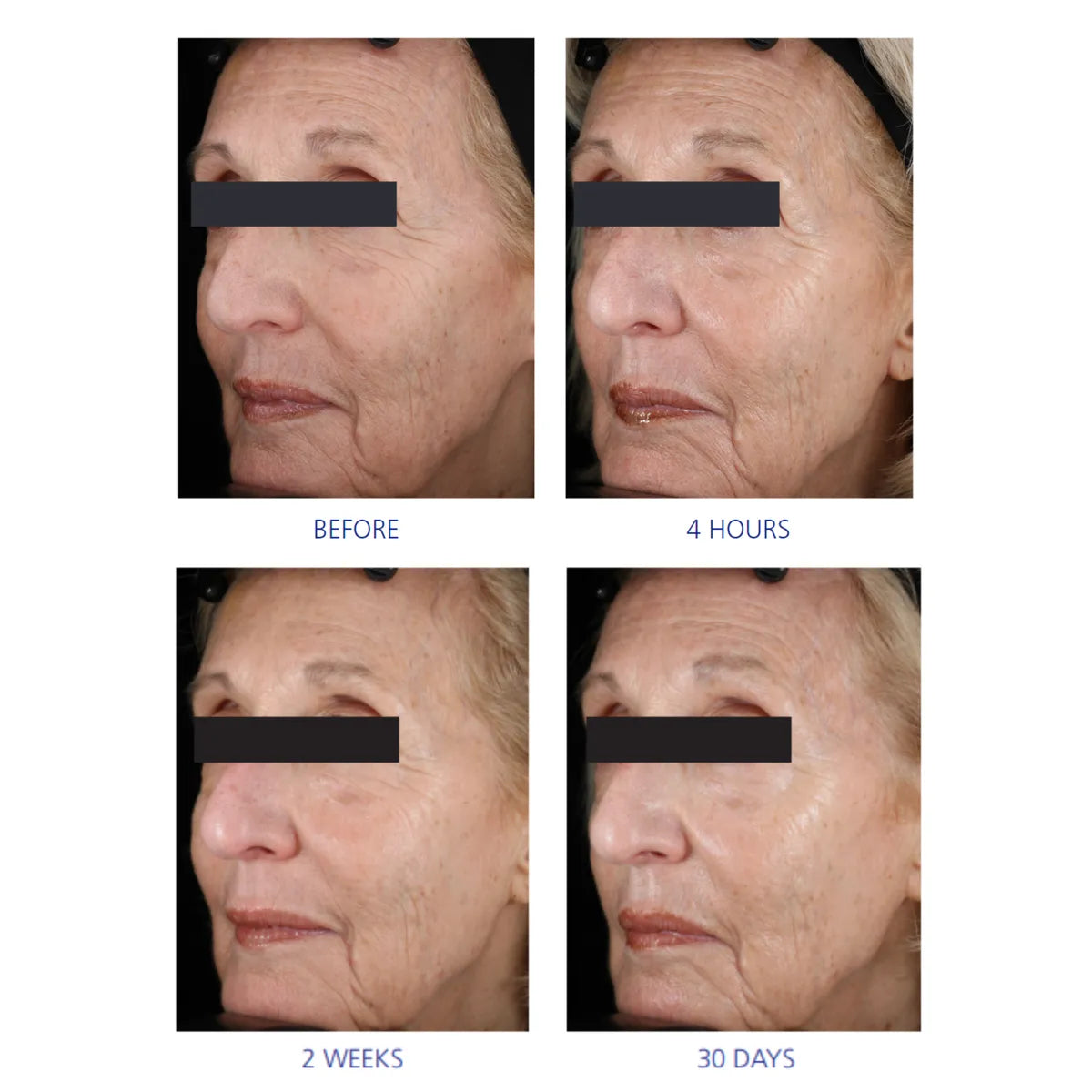 Youth Eye Complex by iS Clinical UK